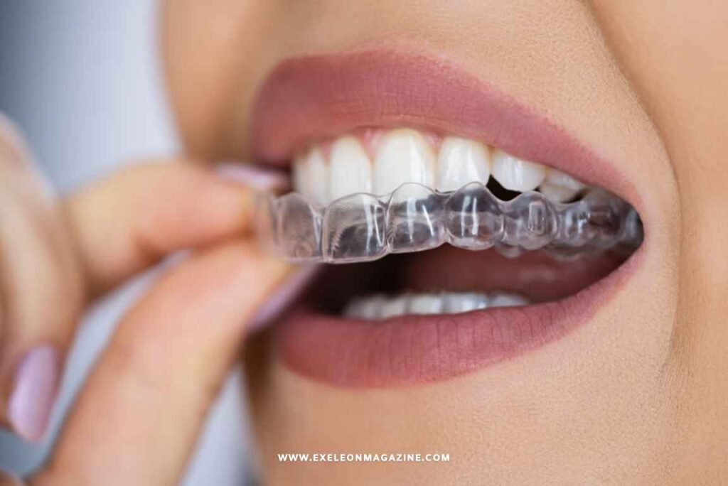 Invisible Aligners with Perfect Smile of a Girl