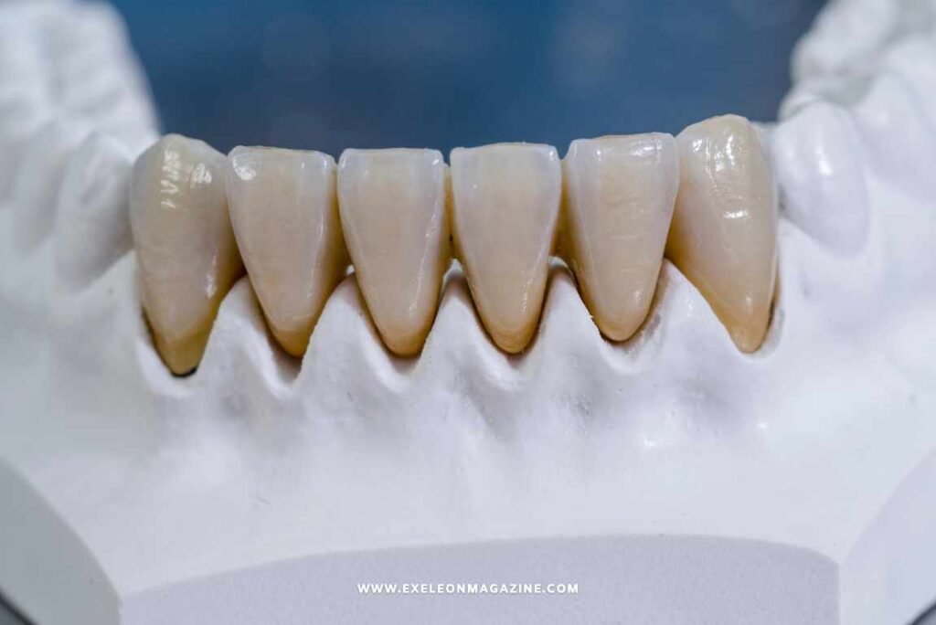Zirconia Crowns
