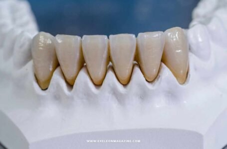 Everything You Need to Know About Zirconia Crowns: The Future of Dental Restoration