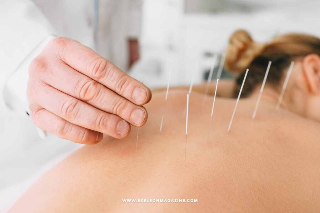 Acupuncture in williamsburg