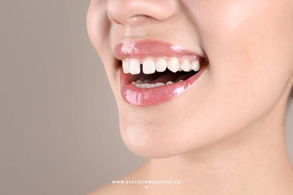 Front Teeth